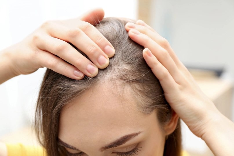 how much hair do you lose during seasonal shedding